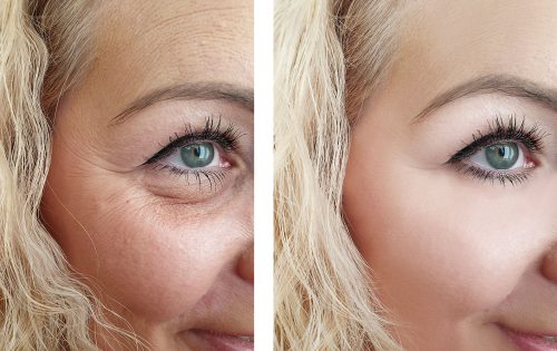 iStock-1134493953
