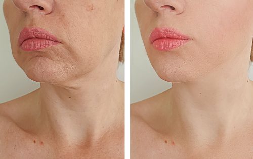 iStock-1176161560